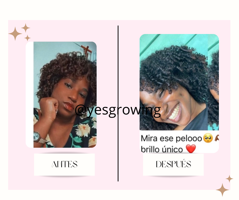 post facebook antes y despues estetica skincare verde agua y rosa 10