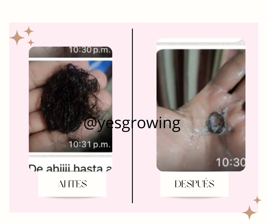 post facebook antes y despues estetica skincare verde agua y rosa 12