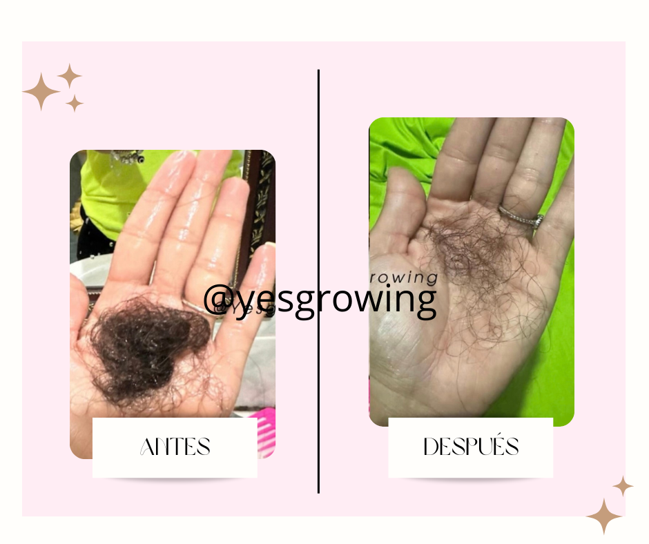 post facebook antes y despues estetica skincare verde agua y rosa 13