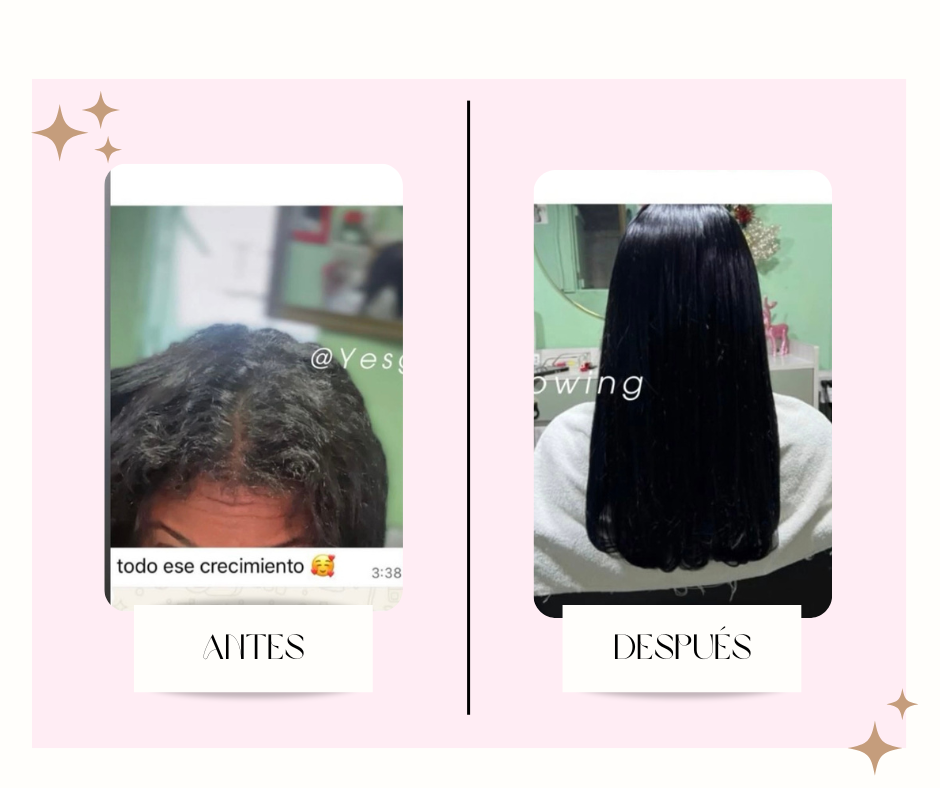 post facebook antes y despues estetica skincare verde agua y rosa 14