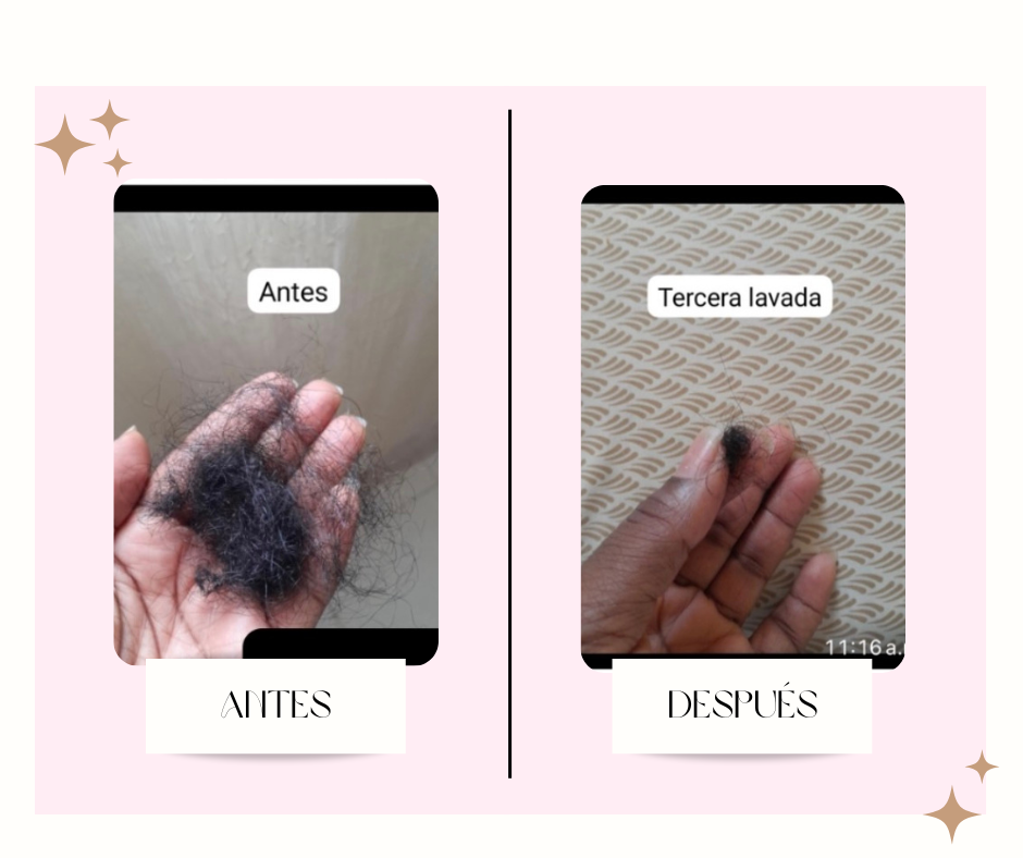 post facebook antes y despues estetica skincare verde agua y rosa 15