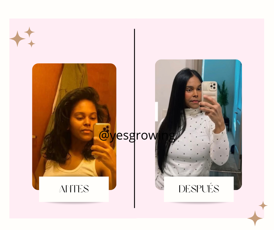 post facebook antes y despues estetica skincare verde agua y rosa 4