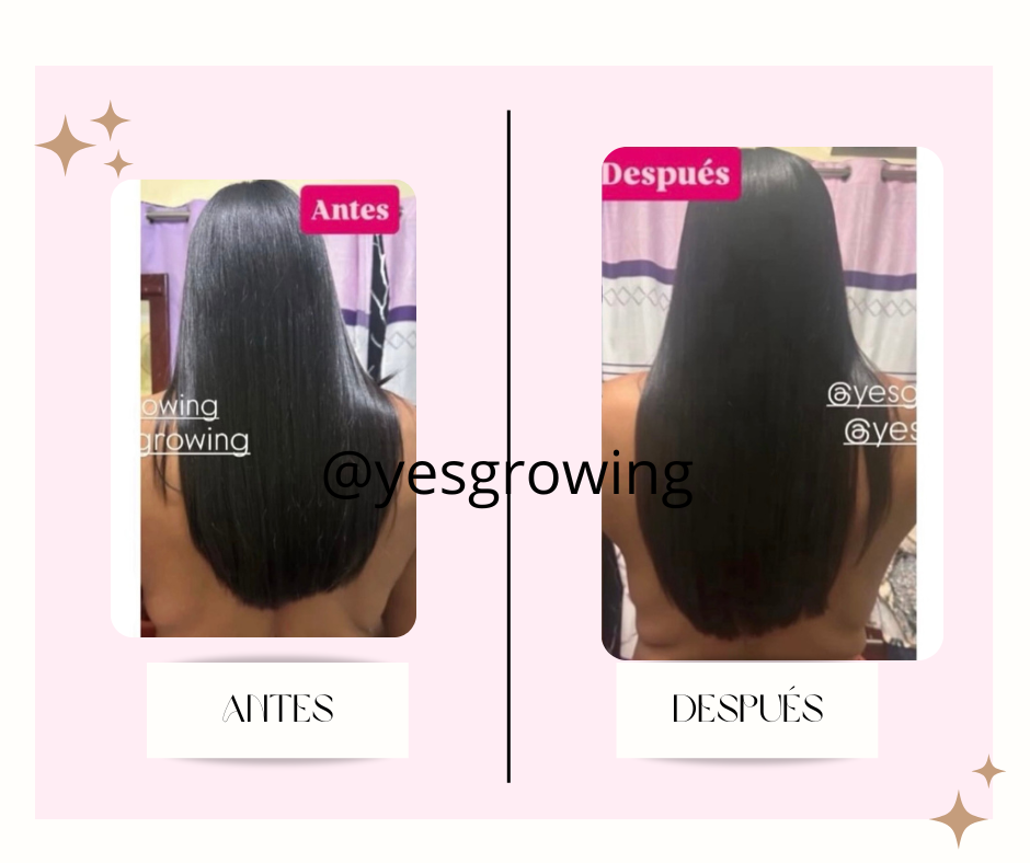 post facebook antes y despues estetica skincare verde agua y rosa 6