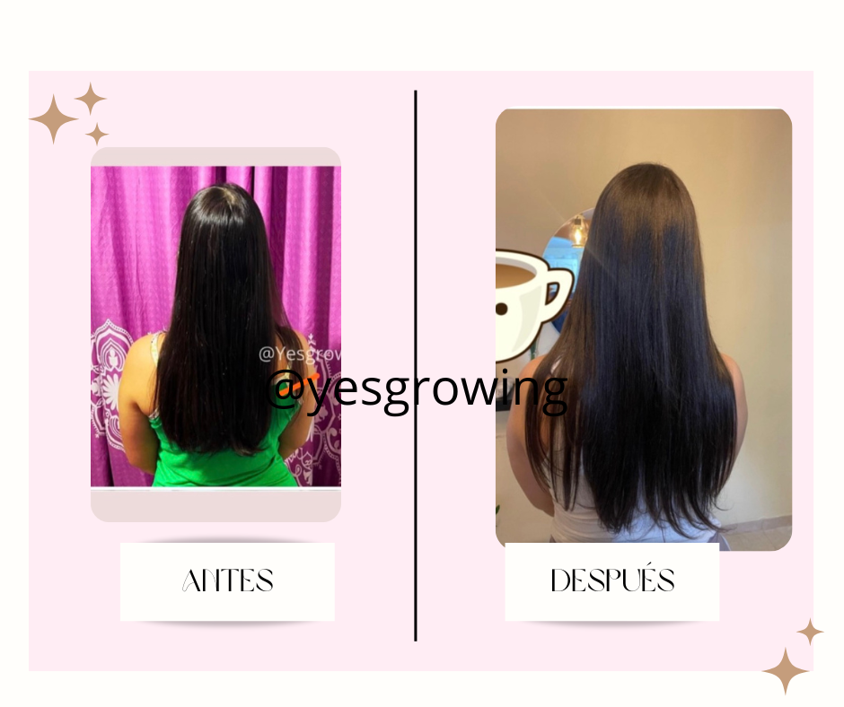 post facebook antes y despues estetica skincare verde agua y rosa 8