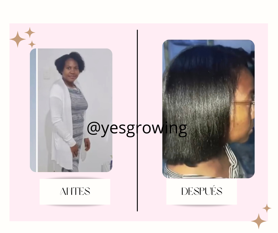 post facebook antes y despues estetica skincare verde agua y rosa 9